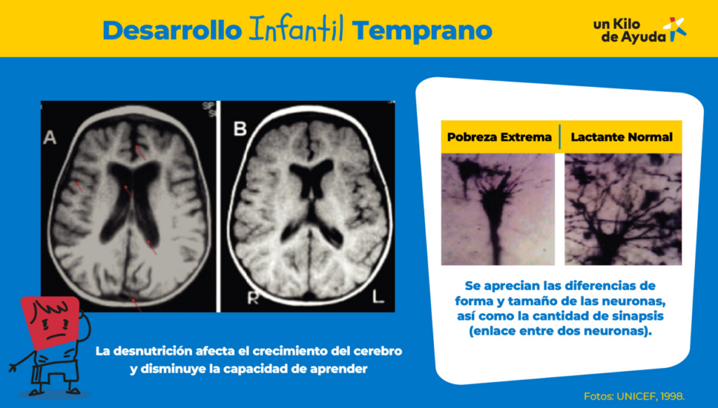 Llamado urgente por la niñez menor de cinco años