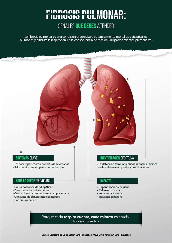 Tos persistente y falta de aire: fibrosis pulmonar