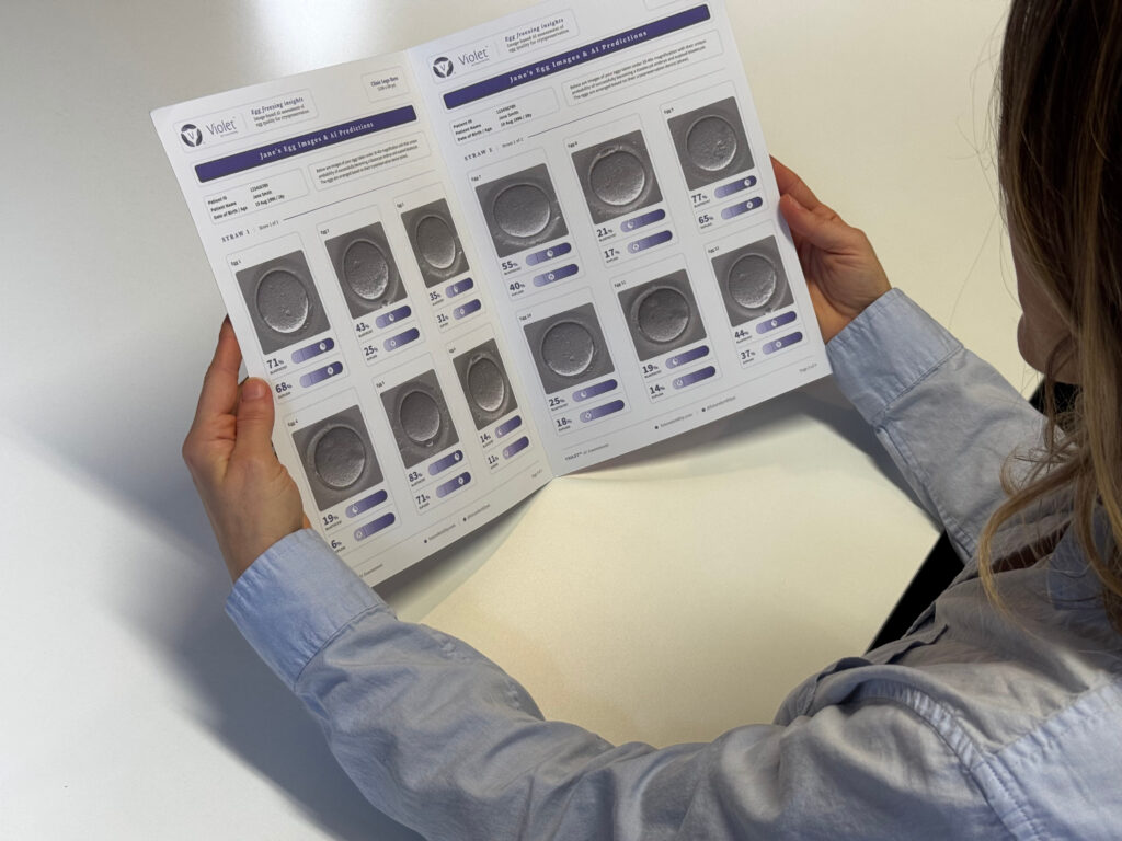 Año nuevo- nuevas opciones: la congelación de óvulos