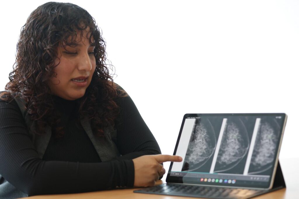 Desarrolla IPN sistema con IA para cáncer de mama